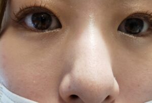 パーフェクトポアカバーを塗った肌を別の角度から見てみました②|化粧品専門店柳屋
